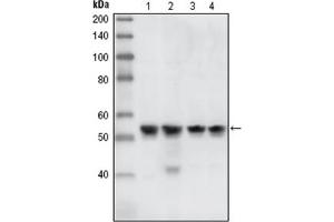Western Blotting (WB) image for anti-Checkpoint Kinase 1 (CHEK1) antibody (ABIN1106682) (CHEK1 Antikörper)