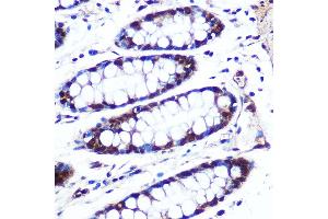 Immunohistochemistry of paraffin-embedded human colon using APIP Rabbit pAb (ABIN6131310, ABIN6136985, ABIN6136986 and ABIN6222909) at dilution of 1:100 (40x lens). (APIP Antikörper  (AA 1-242))