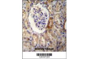NR3C1 Antibody immunohistochemistry analysis in formalin fixed and paraffin embedded human kidney tissue followed by peroxidase conjugation of the secondary antibody and DAB staining. (Glucocorticoid Receptor Antikörper  (C-Term))