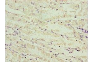 Immunohistochemistry (IHC) image for anti-NADH Dehydrogenase (Ubiquinone) Fe-S Protein 6, 13kDa (NADH-Coenzyme Q Reductase) (NDUFS6) (AA 29-124) antibody (ABIN7160967)
