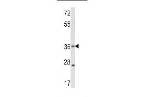 Western Blotting (WB) image for anti-Gap Junction Protein, beta 3, 31kDa (GJB3) (AA 227-257), (C-Term) antibody (ABIN5536021)