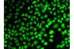 Immunofluorescence analysis of MCF7 cells using XPO5 antibody. (XPO5 Antikörper  (AA 925-1204))