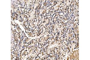 IHC analysis of HIP1R using anti-HIP1R antibody (ABIN7601290).