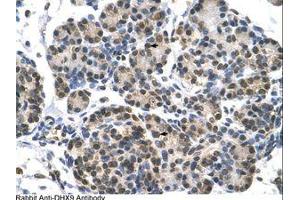 Image no. 1 for anti-ATP-Dependent RNA Helicase A (DHX9) (AA 171-220) antibody (ABIN6736602) (DHX9 Antikörper  (AA 171-220))