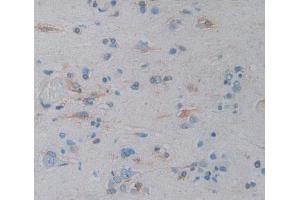 IHC-P analysis of Kidney tissue, with DAB staining. (ICAM-3/CD50 Antikörper  (AA 46-197))
