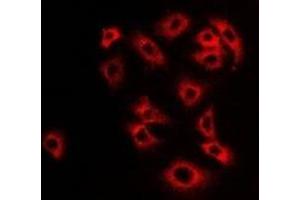 Immunofluorescent analysis of Monoamine Oxidase B staining in Hela cells. (Monoamine Oxidase B Antikörper)