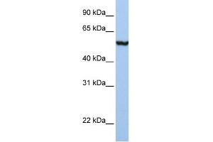 WB Suggested Anti-SLC39A5 Antibody Titration:  1 ug/ml  Positive Control:  Placenta (SLC39A5 Antikörper  (N-Term))