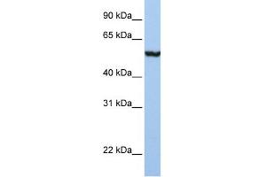 WB Suggested Anti-SLC39A5 Antibody Titration:  1 ug/ml  Positive Control:  Placenta (SLC39A5 Antikörper  (N-Term))