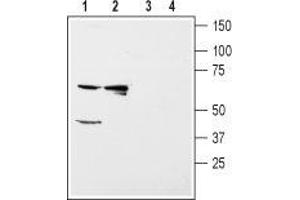 Western blot analysis of rat kidney (lanes 1 and 3) and liver (lanes 2 and 4) membranes: - 1,2. (KIR5.1 Antikörper  (C-Term, Intracellular))