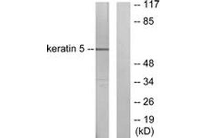 Western blot analysis of extracts from HepG2 cells, using Keratin 5 Antibody.