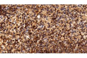 Detection of CD45 in Human Spleen Tissue using Polyclonal Antibody to Protein Tyrosine Phosphatase Receptor Type C (CD45)
