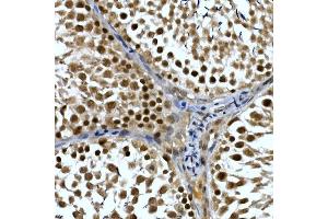 Immunohistochemistry of paraffin-embedded rat testis using NELFCD Rabbit pAb (ABIN1683024, ABIN3019182, ABIN3019183 and ABIN6220747) at dilution of 1:50 (40x lens). (TH1-Like Antikörper  (AA 355-599))