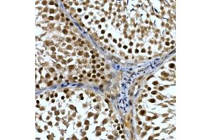 Immunohistochemistry of paraffin-embedded rat testis using NELFCD Rabbit pAb (ABIN1683024, ABIN3019182, ABIN3019183 and ABIN6220747) at dilution of 1:50 (40x lens).