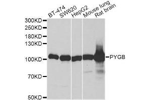 Western blot analysis of extracts of various cell lines, using PYGB antibody. (PYGB Antikörper  (AA 544-843))