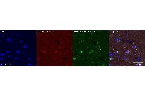 Immunohistochemistry (IHC) image for anti-PDZ and LIM Domain 5 (PDLIM5) antibody (ABIN7456073) (PDLIM5 Antikörper)