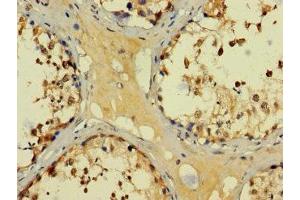 Immunohistochemistry of paraffin-embedded human testis tissue using ABIN7145137 at dilution of 1:100 (BAGE3 Antikörper  (AA 18-109))