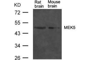 Western blot analysis of extract from rat brain and mouse brain tissue using MEK5 Antibody (MAP2K5 Antikörper  (AA 311-315))
