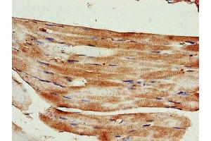 Immunohistochemistry of paraffin-embedded human skeletal muscle tissue using ABIN7157595 at dilution of 1:100 (KIF14 Antikörper  (AA 261-531))