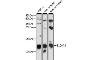 Western blot analysis of extracts of various cell lines, using S100 antibody (ABIN7270129) at 1:1000 dilution.