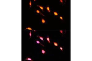 Immunofluorescence analysis of U-2 OS cells using GTF3C4 Polyclonal Antibody  at dilution of 1:100 (40x lens). (GTF3C4 Antikörper  (AA 583-822))