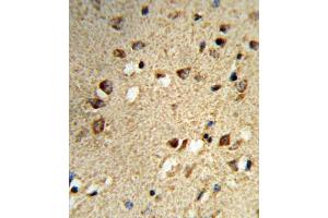 Immunohistochemistry (IHC) image for anti-Nuclear Receptor Coactivator 7 (NCOA7) antibody (ABIN3004220) (NCOA7 Antikörper)