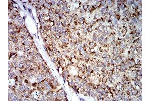 Immunohistochemistry (IHC) image for anti-Tripartite Motif Containing 25 (TRIM25) (AA 211-360) antibody (ABIN5542675)