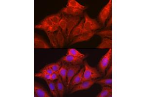Immunofluorescence analysis of U2OS cells using Galectin 1/LG Rabbit pAb (ABIN6130424, ABIN6143156, ABIN6143157 and ABIN6218649) at dilution of 1:50 (40x lens). (LGALS1/Galectin 1 Antikörper  (AA 1-135))