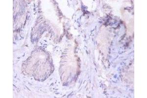 Immunohistochemistry (IHC) image for anti-Proteasome (Prosome, Macropain) Subunit, beta Type, 4 (PSMB4) (AA 46-264) antibody (ABIN7164978)
