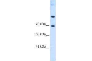 Western Blotting (WB) image for anti-Solute Carrier Family 7 (Cationic Amino Acid Transporter, Y+ System), Member 4 (SLC7A4) antibody (ABIN2462744) (SLC7A4 Antikörper)