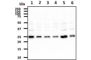 The cell lysates (40ug) were resolved by SDS-PAGE, transferred to PVDF membrane and probed with anti-human REXO2 antibody (1:500). (REXO2 Antikörper)