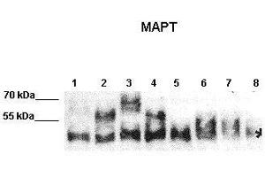 WB Suggested Anti-MAPT Antibody    Positive Control:  Lane 1: 10ug N2A expressed human Tau-C Lane 2: 10ug N2A expressed human Tau-E Lane 3: 10ug N2A expressed human Tau-F Lane 4: 10ug N2A expressed human Tau-B Lane 5: 10ug N2A expressed human Fetal-Tau Lane 6: 10ug N2A expressed human Tau-D Lane 7: 10ug N2A expressed human much Fetal-Tau Lane 8: 10ug N2A lysate   Primary Antibody Dilution :   1:2000  Secondary Antibody :  Donkey anti-rabbit-HRP   Secondry Antibody Dilution :   1:10,000   Submitted by:  Max Holzer, Paul Flechsig Institut of Brain Research, University of Leipzig (MAPT Antikörper  (Middle Region))