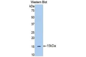 Detection of Recombinant IL13Ra2, Human using Polyclonal Antibody to Interleukin 13 Receptor Alpha 2 (IL13Ra2) (IL13RA2 Antikörper  (AA 238-334))