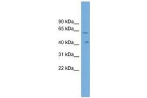 Image no. 1 for anti-Solute Carrier Family 22, Member 10 (SLC22A10) (AA 431-480) antibody (ABIN6744750) (SLC22A10 Antikörper  (AA 431-480))