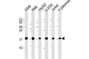 All lanes : Anti-COD1 Antibody (N-Term) at 1:2000 dilution Lane 1: A549 whole cell lysate Lane 2: Hela whole cell lysate Lane 3: HepG2 whole cell lysate Lane 4: U-2OS whole cell lysate Lane 5: Jurkat whole cell lysate Lane 6: human placenta lysate Lysates/proteins at 20 μg per lane. (COMMD1 Antikörper)