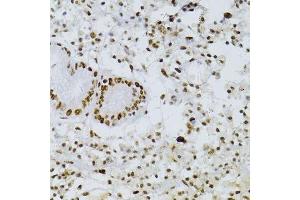 Immunohistochemistry of paraffin-embedded human stomach using SNRNP70 antibody. (SNRNP70 Antikörper  (AA 150-250))