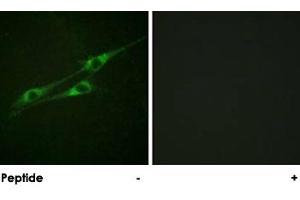 Immunofluorescence analysis of NIH/3T3 cells, using IL13RA1 polyclonal antibody . (IL13 Receptor alpha 1 Antikörper)