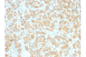 Formalin-fixed, paraffin-embedded human Pancreas stained with GP2 Recombinant Rabbit Monoclonal Antibody (GP2/2569R). (Rekombinanter GP2 Antikörper  (AA 35-179))