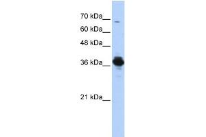 WB Suggested Anti-ATP6V0D2 Antibody Titration: 0.