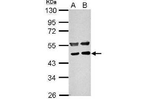 WB Image Sample (30 ug of whole cell lysate) A: NIH-3T3 B: JC 10% SDS PAGE antibody diluted at 1:1000 (PPME1 Antikörper)