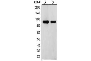 Western blot analysis of Transglutaminase 2 expression in ECV304 (A), TF1 (B) whole cell lysates. (Transglutaminase 2 Antikörper  (N-Term))