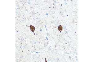 Immunohistochemistry of paraffin-embedded Rat brain using Parvalbumin (Parvalbumin (PVALB)) Rabbit pAb (ABIN3016700, ABIN3016701, ABIN3016702 and ABIN6219820) at dilution of 1:100 (40x lens). (PVALB Antikörper)