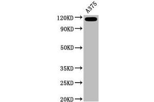 Western Blot Positive WB detected in A375 whole cell lysate All lanes CD146 antibody at 0. (Rekombinanter MCAM Antikörper)