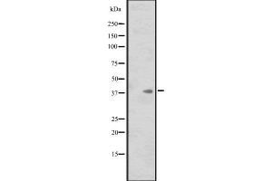 Western blot analysis of ISL1 expression in HL60 whole cell lysate ,The lane on the left is treated with the antigen-specific peptide. (ISL1 Antikörper  (Internal Region))