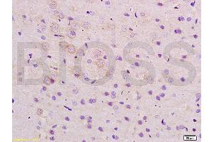 Formalin-fixed and paraffin embedded rat brain tissue labeled with Anti-ARHGAP32 Polyclonal Antibody, Unconjugated (ABIN1386112) at 1:200 followed by conjugation to the secondary antibody and DAB staining