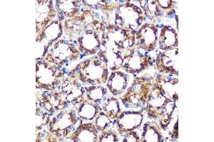 Immunohistochemistry of paraffin-embedded mouse kidney using NOX/p67phox Rabbit mAb (ABIN1679067, ABIN7101556, ABIN7101557 and ABIN7101558) at dilution of 1:100 (40x lens). (NCF2 Antikörper)