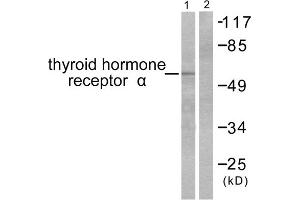 Western blot analysis of extracts from SKOV3 cells, using Thyroid Hormone Receptor alpha antibody (ABIN5976520).