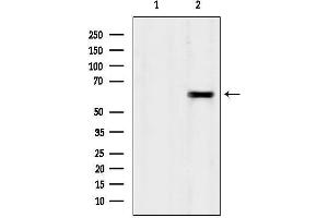 anti-Tectonic Family Member 1 (TCTN1) (N-Term) antibody