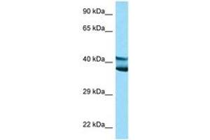 Image no. 1 for anti-Ly1 Antibody Reactive (LYAR) (AA 81-130) antibody (ABIN6748222) (LYAR Antikörper  (AA 81-130))