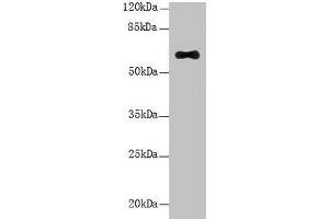 Western Blot All lanes: LRRC31 antibody at 5 μg/mL + Mouse small intestine tissue Secondary Goat polyclonal to rabbit IgG at 1/10000 dilution Predicted band size: 62, 56, 39, 49 kDa Observed band size: 62 kDa (LRRC31 Antikörper  (AA 1-300))