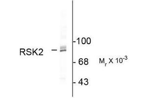 Image no. 1 for anti-Ribosomal Protein S6 Kinase, 90kDa, Polypeptide 3 (RPS6KA3) (C-Term) antibody (ABIN372713) (RPS6KA3 Antikörper  (C-Term))